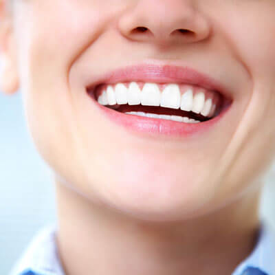 Close-up of the teeth of a laughing woman